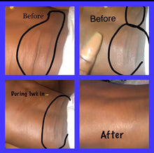 Load image into Gallery viewer, Ready For War Eczema Bundle