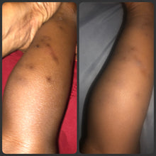 Load image into Gallery viewer, Ready For War Eczema Bundle