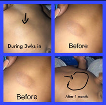 Load image into Gallery viewer, Ready For War Eczema Bundle